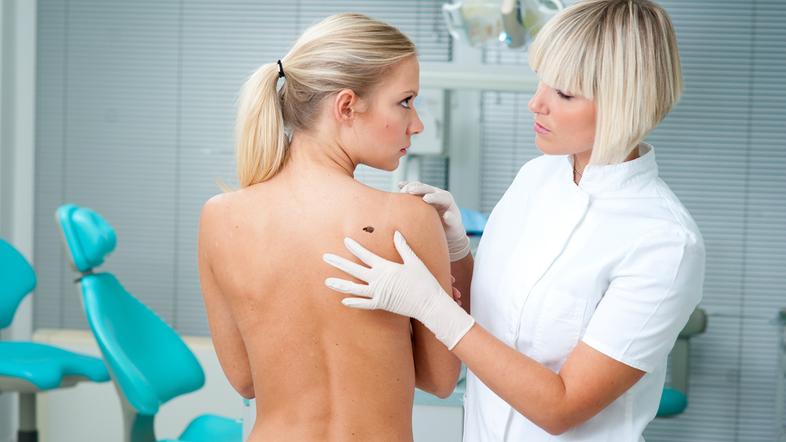 zdravnik pregled koža kožni rak