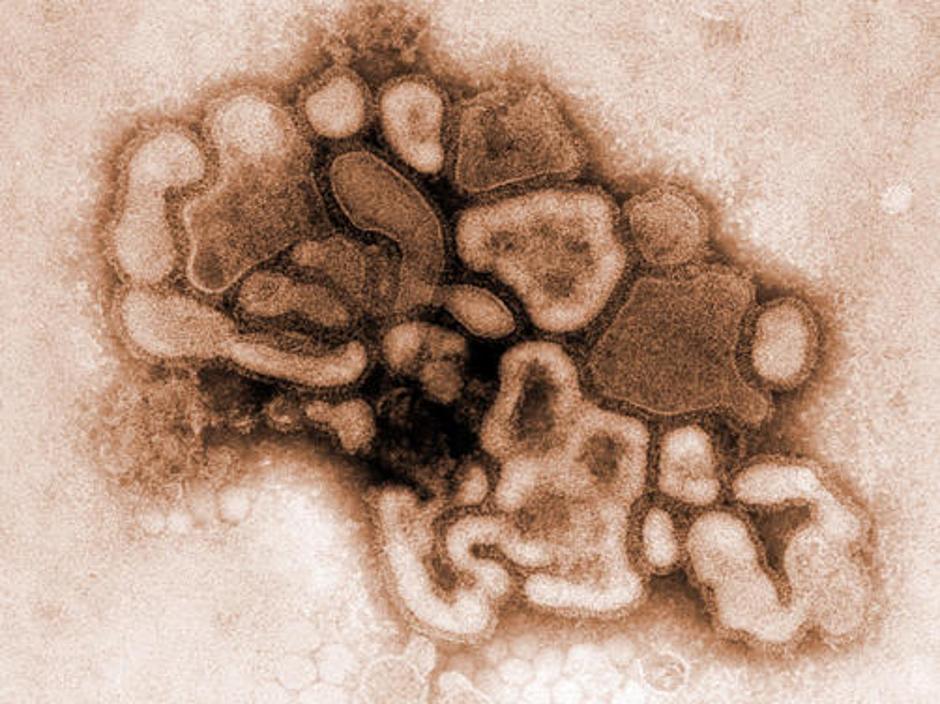 Virus influence H1N1 | Avtor: Žurnal24 main