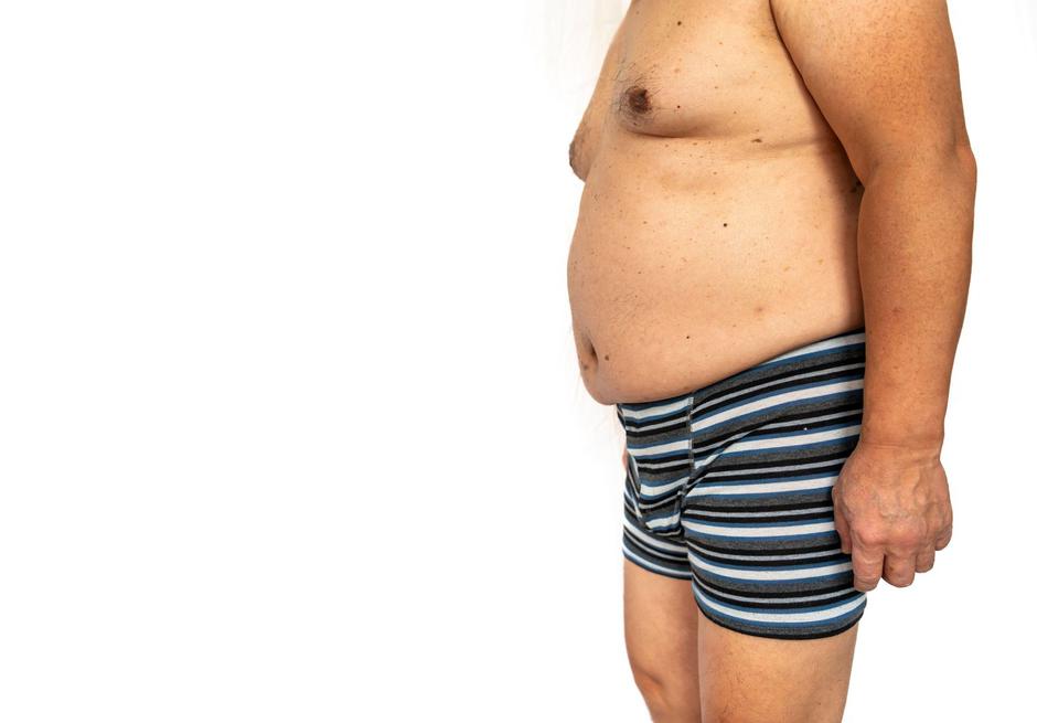 debelost debel moški | Avtor: Profimedia