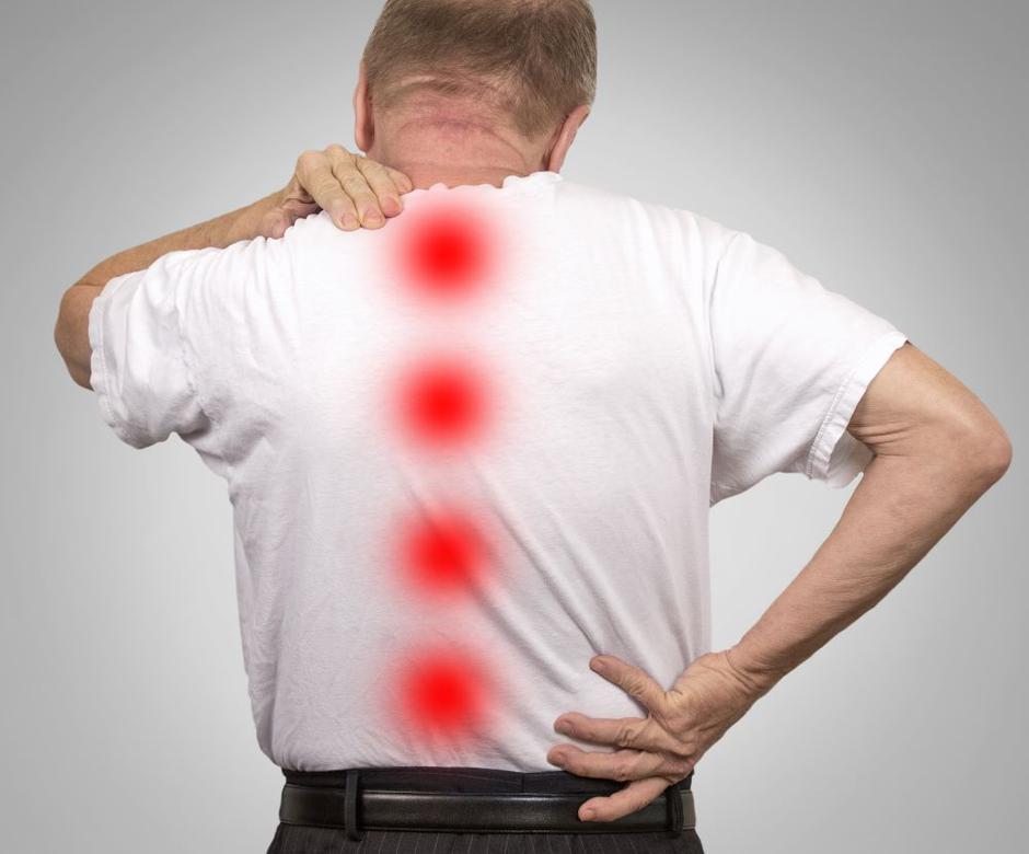 medicofit, hrbet, bolečine, spinalna stenoza | Avtor: Medicofit