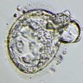 Embrio v zgodnji fazi