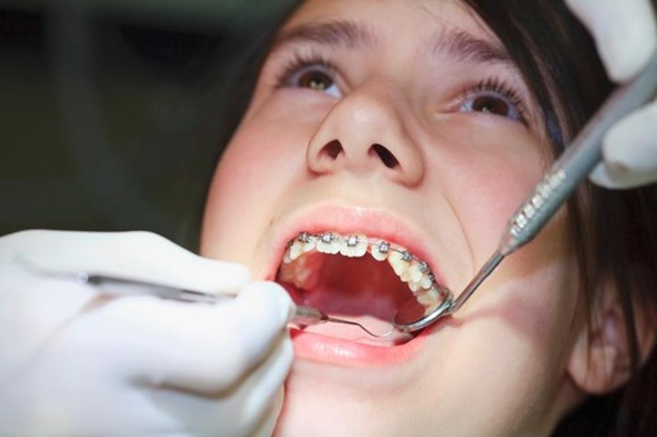 ortodont | Avtor: Profimedias