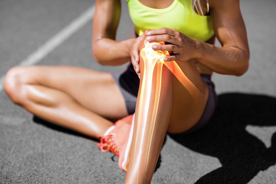 Bolečine v kolenih | Avtor: Profimedia