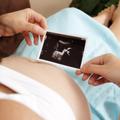 Nekatere ženske z namišljeno nosečnostjo si tudi domišljajo, da na sliki vidijo 