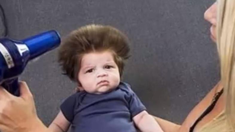 Dojenček ogromno las