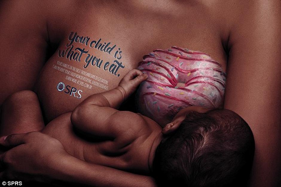 Kampanja brazilskih pediatrov | Avtor: SPRS