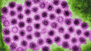 Pnevmokoki bakterije