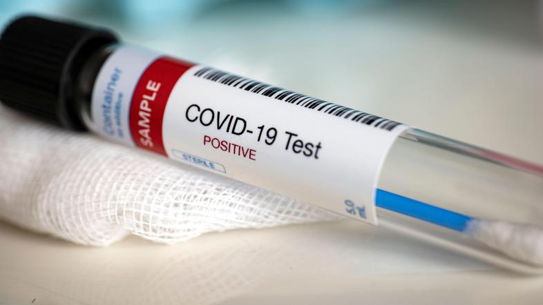 Pozitiven covid-19 test