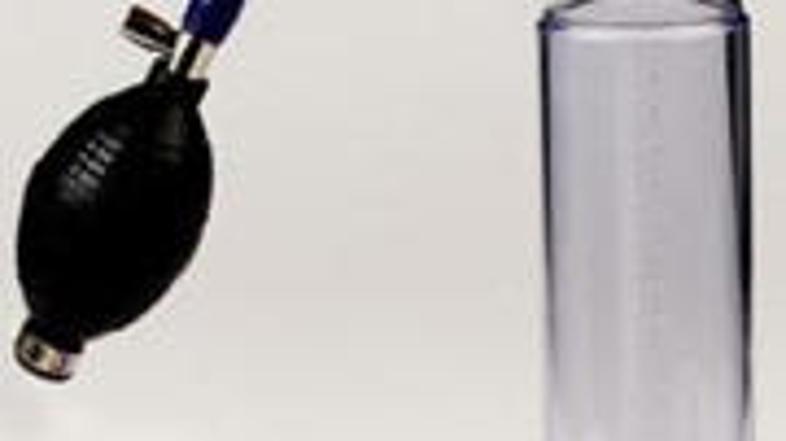 Ni sporno, da ga je hotel povečati. Razburilo jih je, ker ga je hotel povečati m