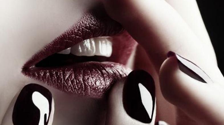 Zala ni imela sreče. (Foto: Shutterstock)