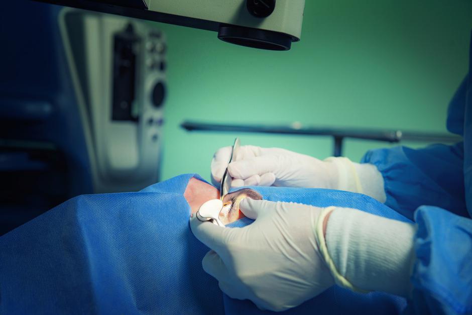 Operacija oči | Avtor: Profimedia