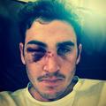 Craig Kieswetter