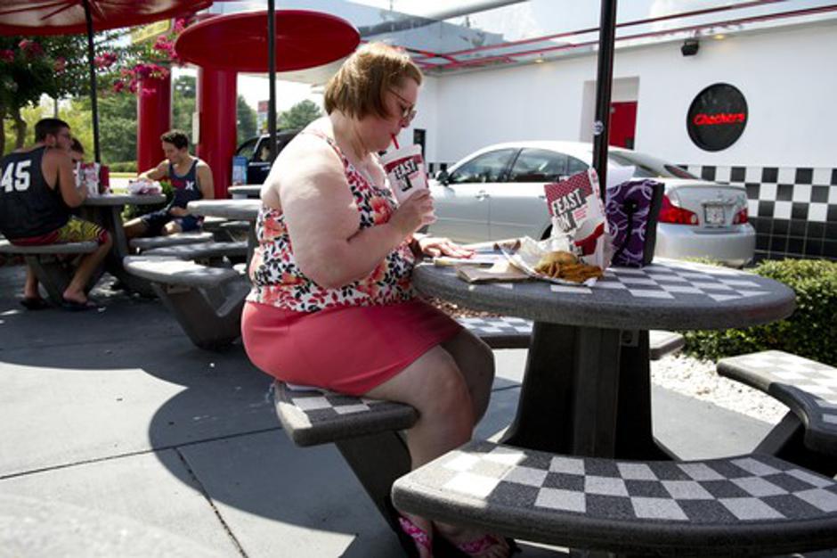 Debelost | Avtor: Profimedias