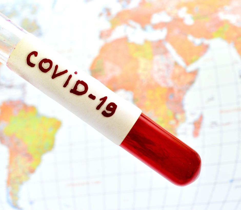 koronavirus | Avtor: Profimedia