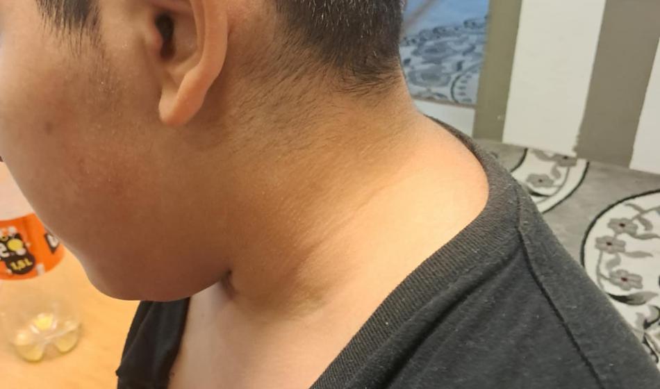 Napad na romskega otroka v Gornji Radgoni: Tako dogodek komentira policija