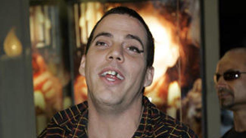 Steve-O je bil v začetku marca hospitaliziran.