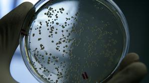 laboratorij analiza bakterij