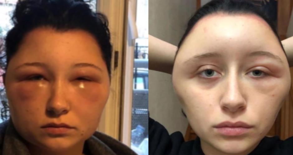 estelle | Avtor: YouTube