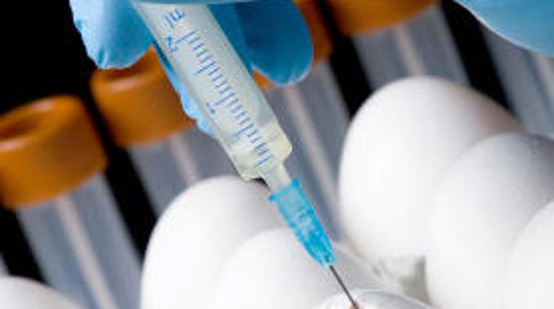 Mislim, da so strokovnaki v Sloveniji dobro usposobljeni in vedo kaj delajo. V l