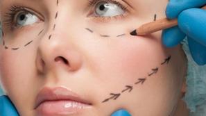 Plastična operacija 