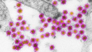 West Nile virus, bolezen zahodnega Nila