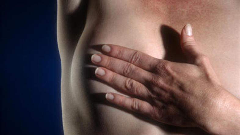 Za rakom na dojkah najpogosteje zbolevajo ženske med 50. in 70. letom.