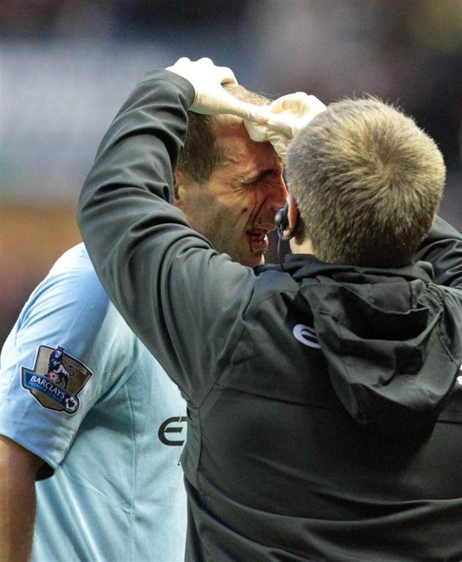 Zabaleta zdravnik povoj poškodba Sunderland Manchester City Premier League Angli | Avtor: EPA