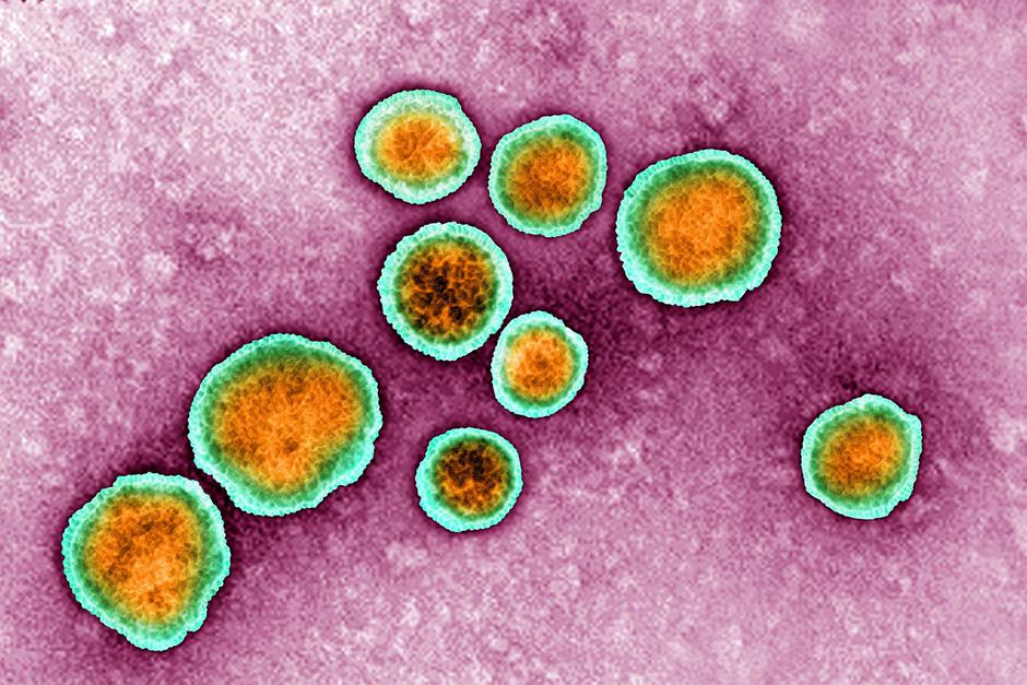 RSV | Avtor: Profimedia