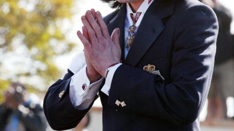 Jackson je imel kožno bolezen vitiligo. (Foto: Flynet/JLP)