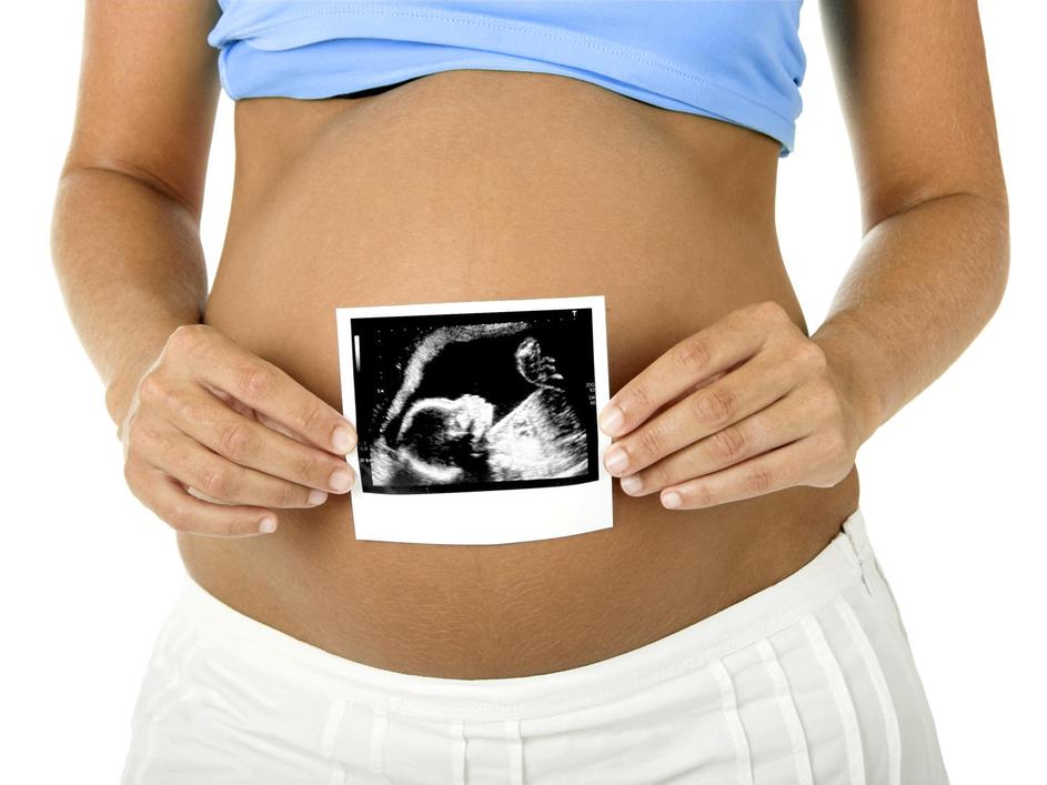 nosečnost, nosečnica, ultrazvok