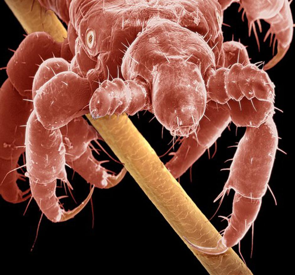 Naglavne uši | Avtor: Profimedias