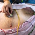prva pomoč, oživljanje