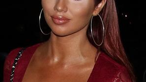  AMY CHILDS
