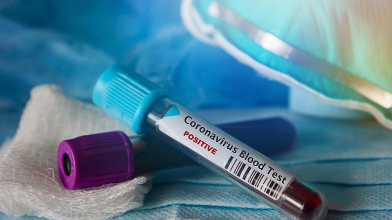 Novi koronavirus