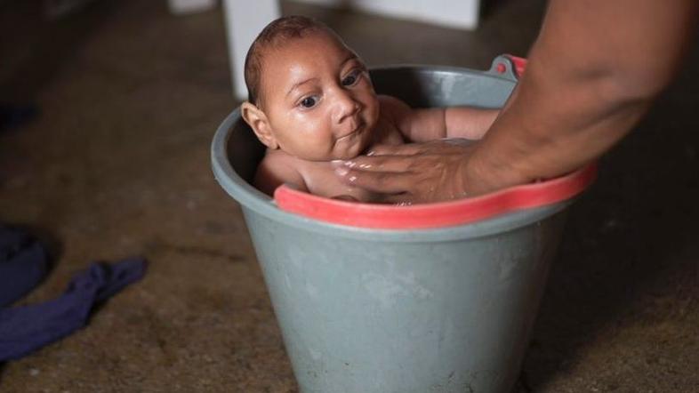 Zika, otrok