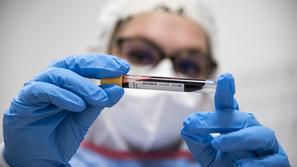 koronavirus covid-19 test