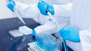 laboratorij poskus epruveta