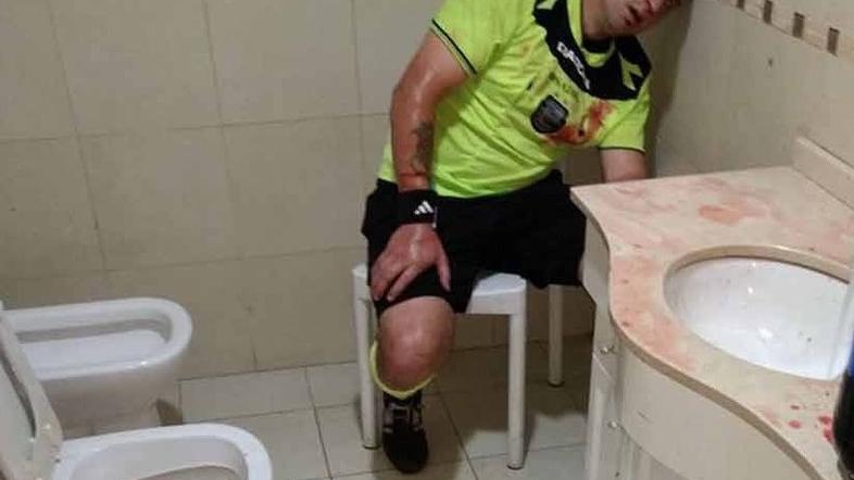 nogometni sodnik kri garderoba