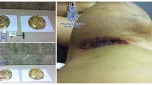 Prsni vsadki s kokainom