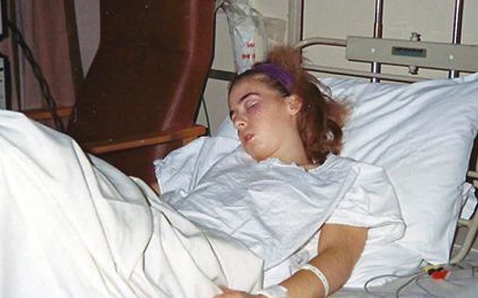 Operacija na možganih | Avtor: Profimedias