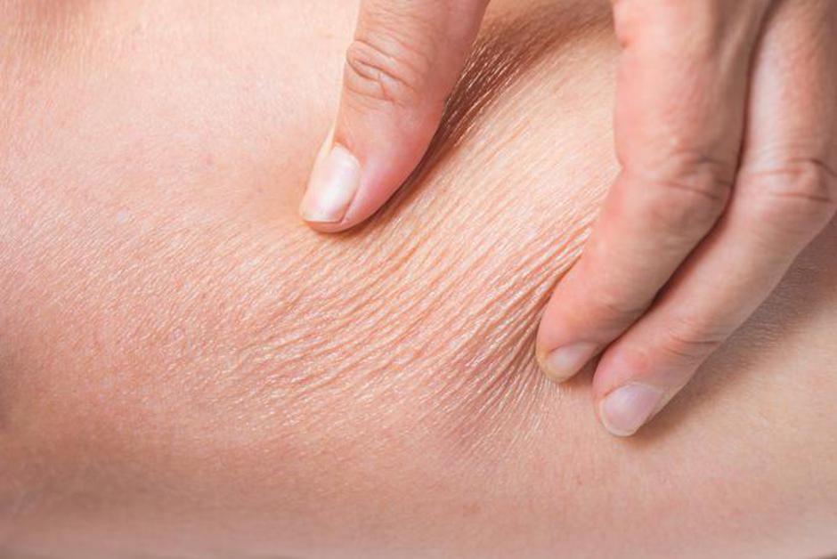 Kolagen DELUJE! Vendar ne storite te usodne napake! | Avtor: Popolna postava