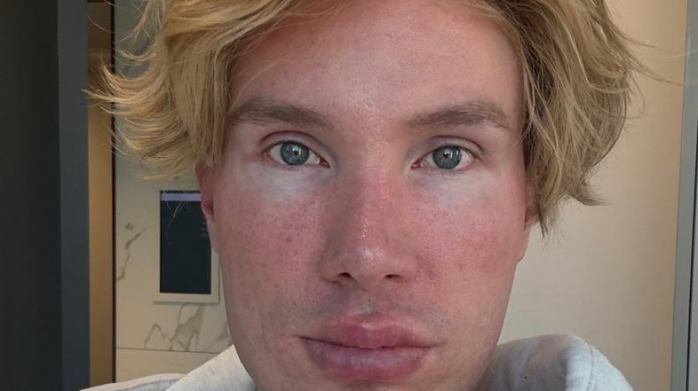 Joni