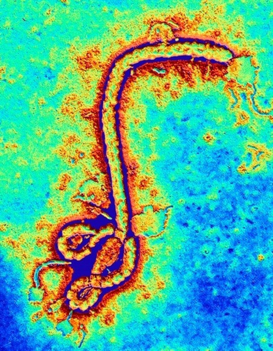 Ebola | Avtor: Profimedias