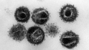 Z elektronskim mikroskopom 240.000-krat povečana slika virusa HIV, povzročitelja