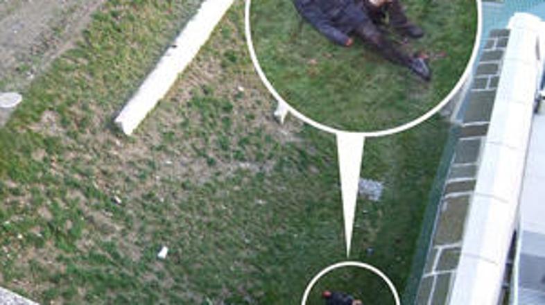 Medved je moškega pogrizel po glavi in nogi. (Foto: dailymail.co.uk)