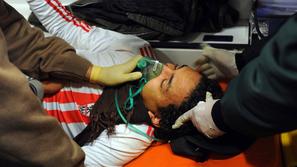 ranjeni egiptovski protestnik