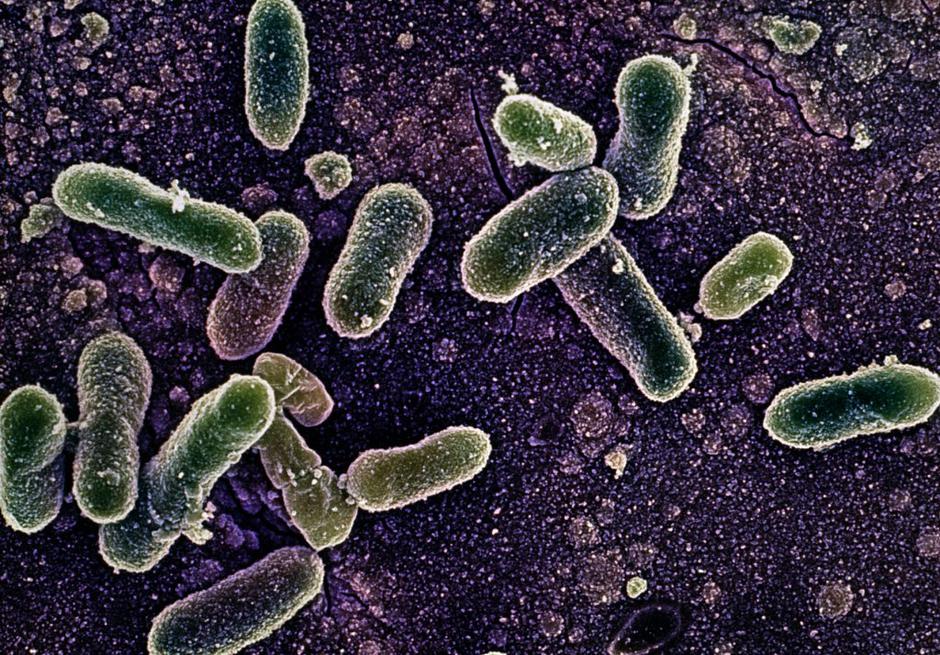 Salmonela | Avtor: Profimedias