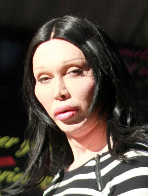 Pete Burns