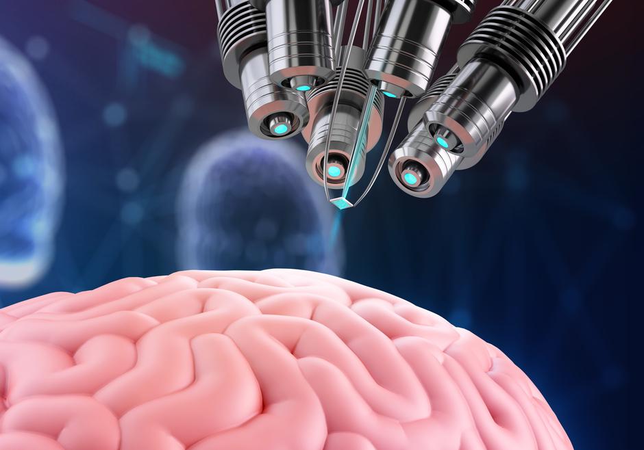 Neuralink možgani čip | Avtor: Profimedia