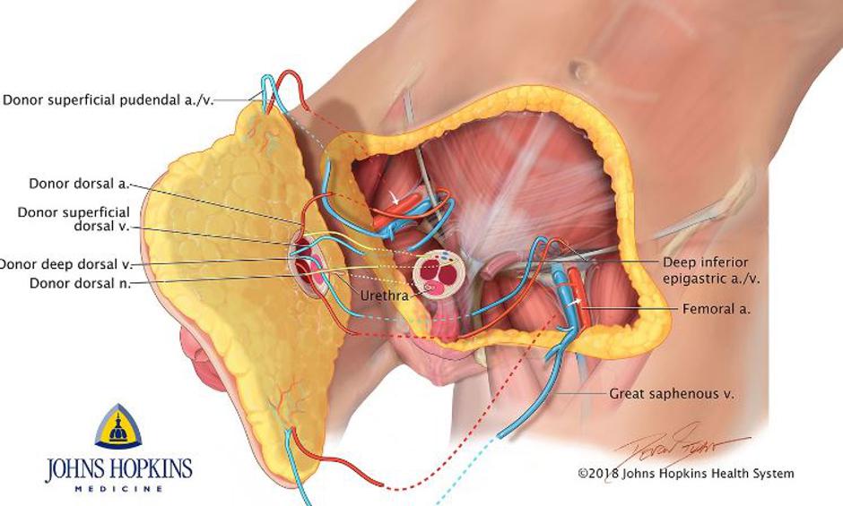  | Avtor: Univerza Johnsa Hopkinsa